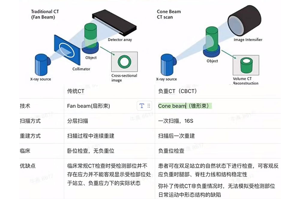 負(fù)重CT和傳統(tǒng)CT有何不同?